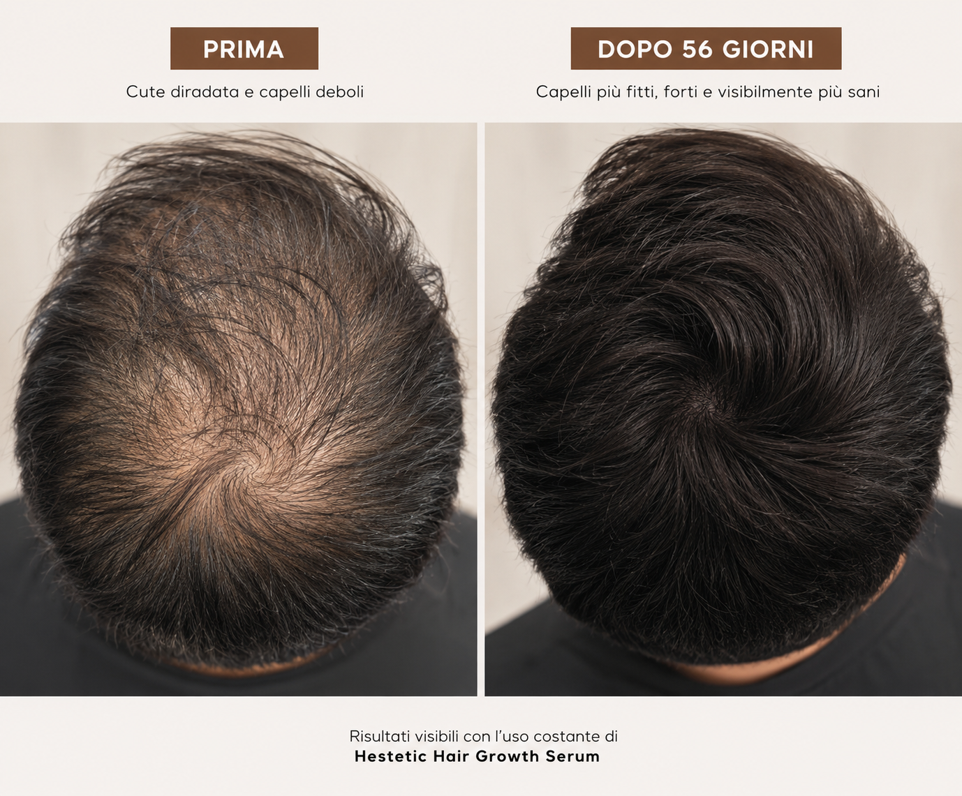 Hestètic Hair Growth Serum™ Bestseller 2026