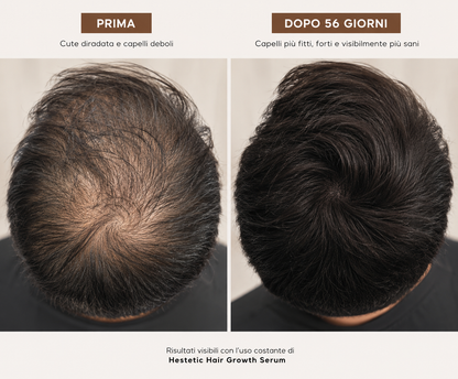 Hestètic Hair Growth Serum™ Bestseller 2026