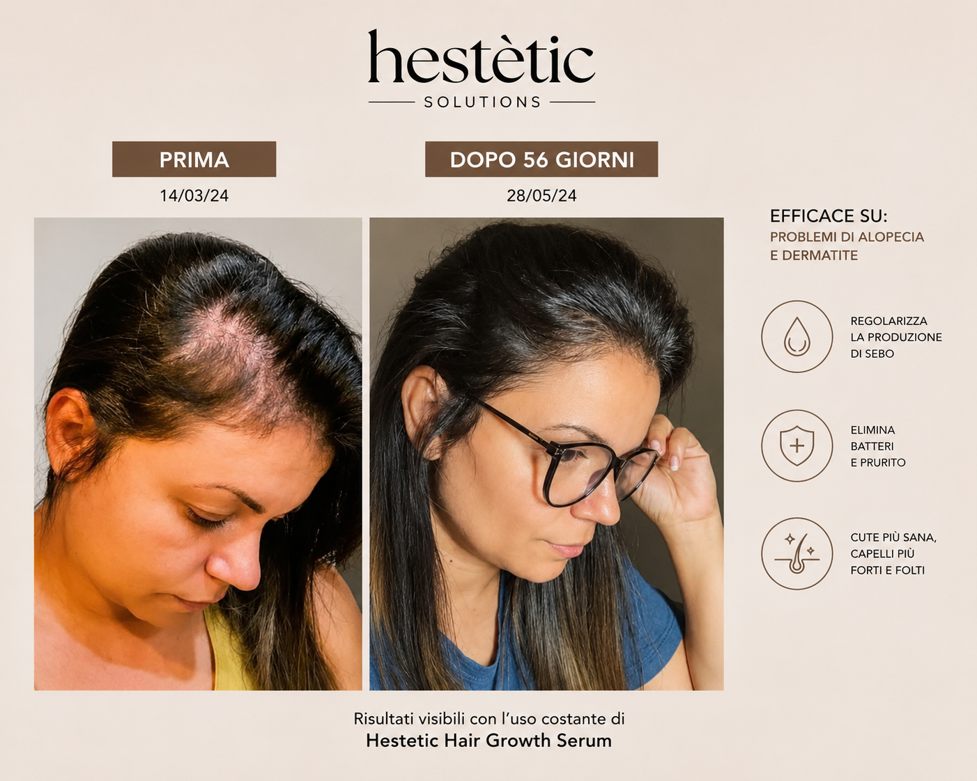 Hestètic Hair Growth Serum™ Bestseller 2026