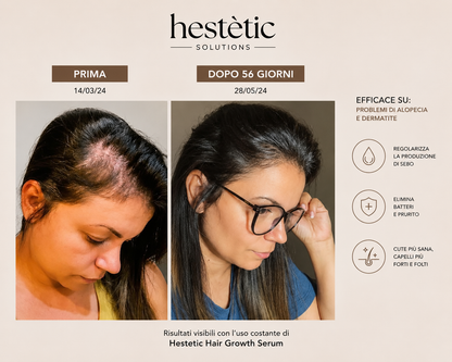 Hestètic Hair Growth Serum™ Bestseller 2026