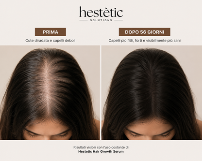 Hestètic Hair Growth Serum™ Bestseller 2026